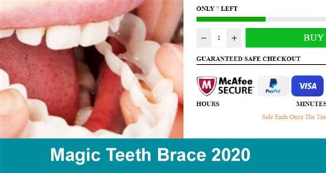 Reviews for magical dental braces
